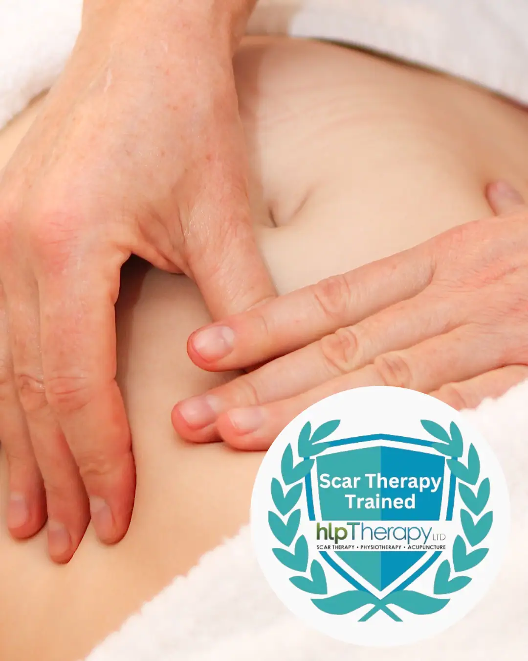 c section scar therapy